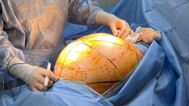 Врачи готовятся к операции