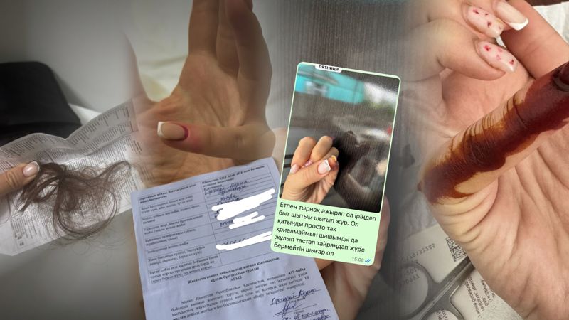 Пациентке вырвали волосы и чуть не оставили без ногтей в больнице Шымкента