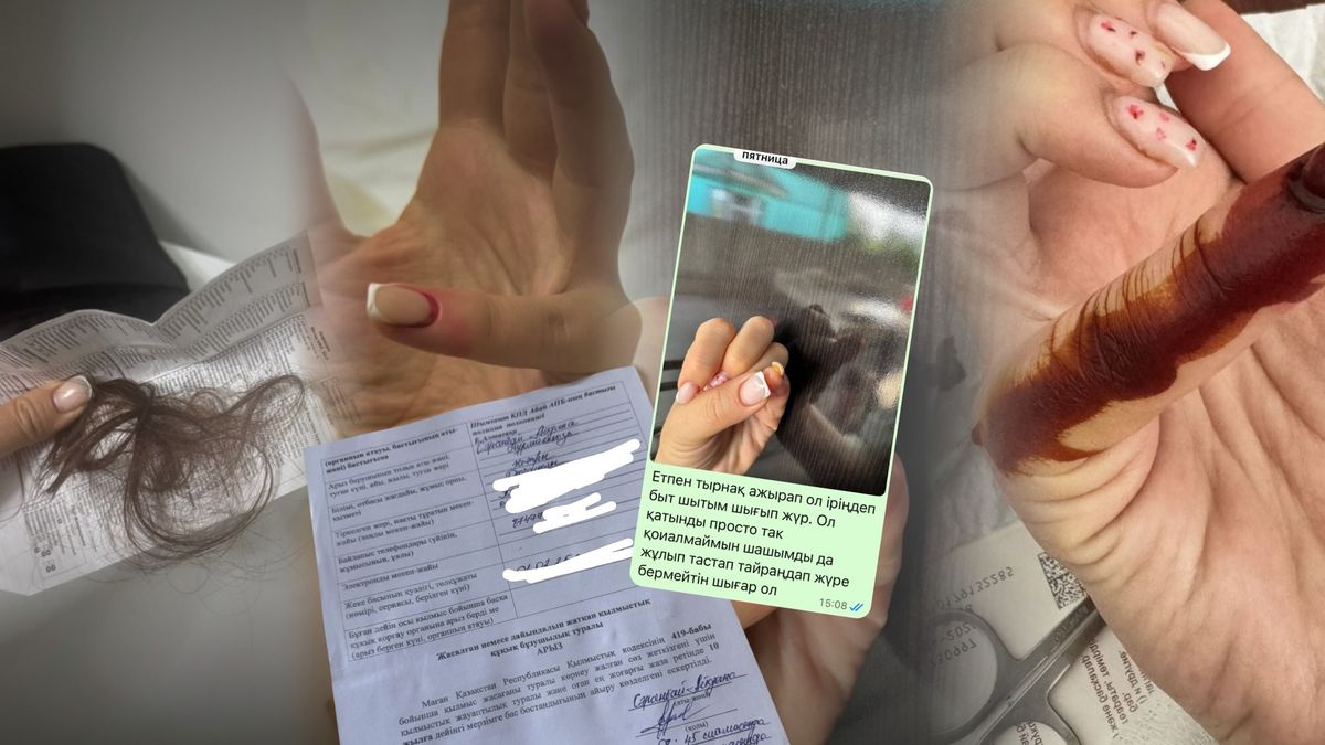 Пациентке вырвали волосы и чуть не оставили без ногтей в больнице Шымкента
