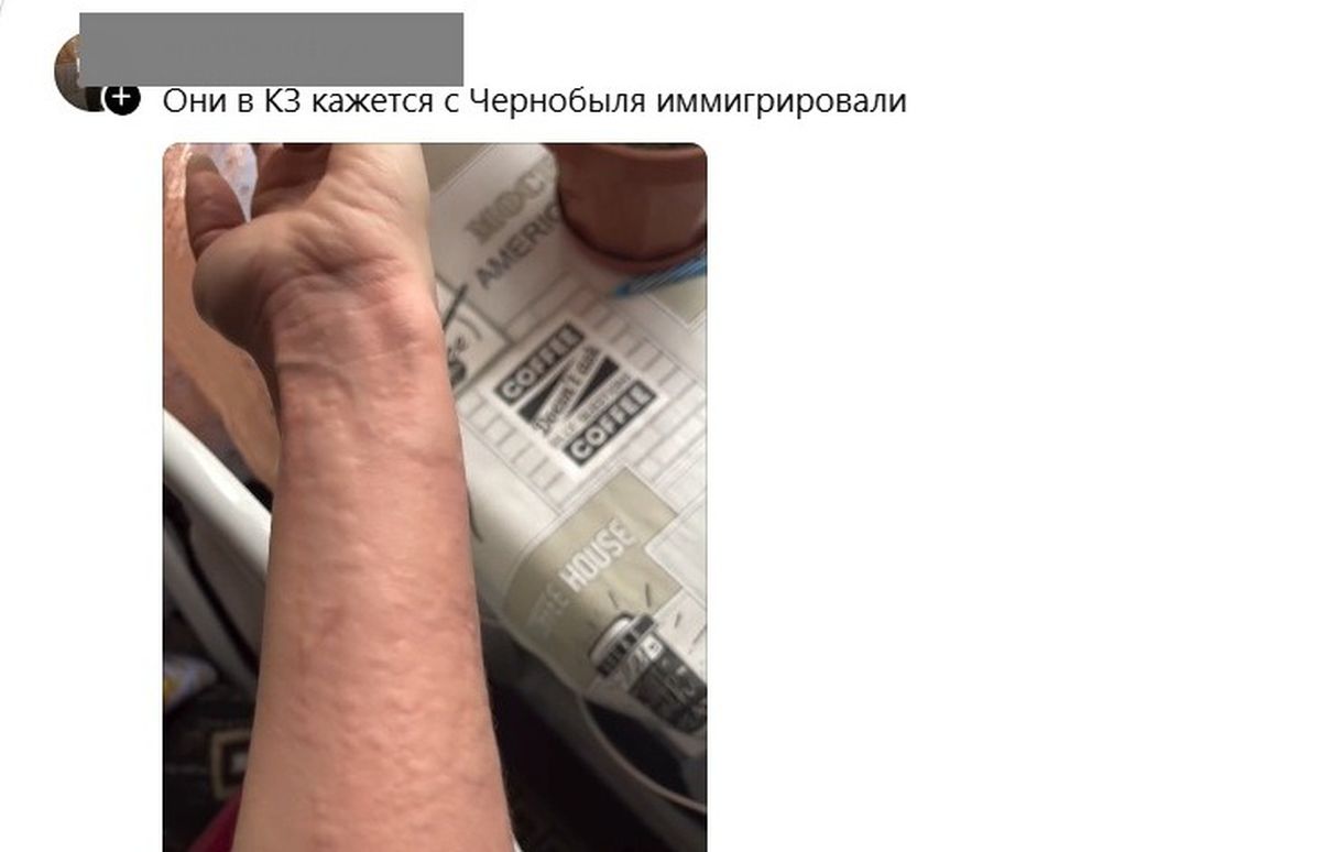Аллергия, рука