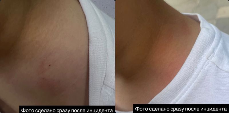 Дело о нападении на ребенка в алматинском семейном центре NEXT прекратили