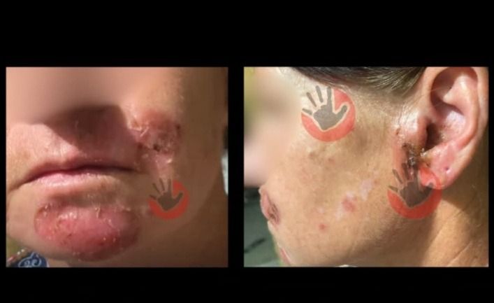 Жертву жутких пыток заставили мириться с мучителями в Таразе