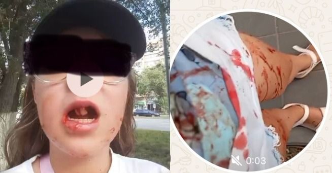 Велокурьер сломал девочке челюсть и выбил зубы в Актобе